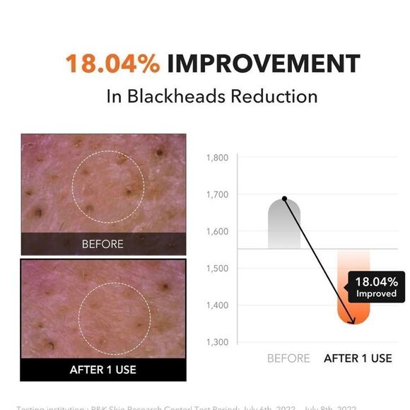 APRILSKIN Carrotene IPMP Hydromelt Cleansing Balm remove makeup helps acne prone - Picture 4 of 10